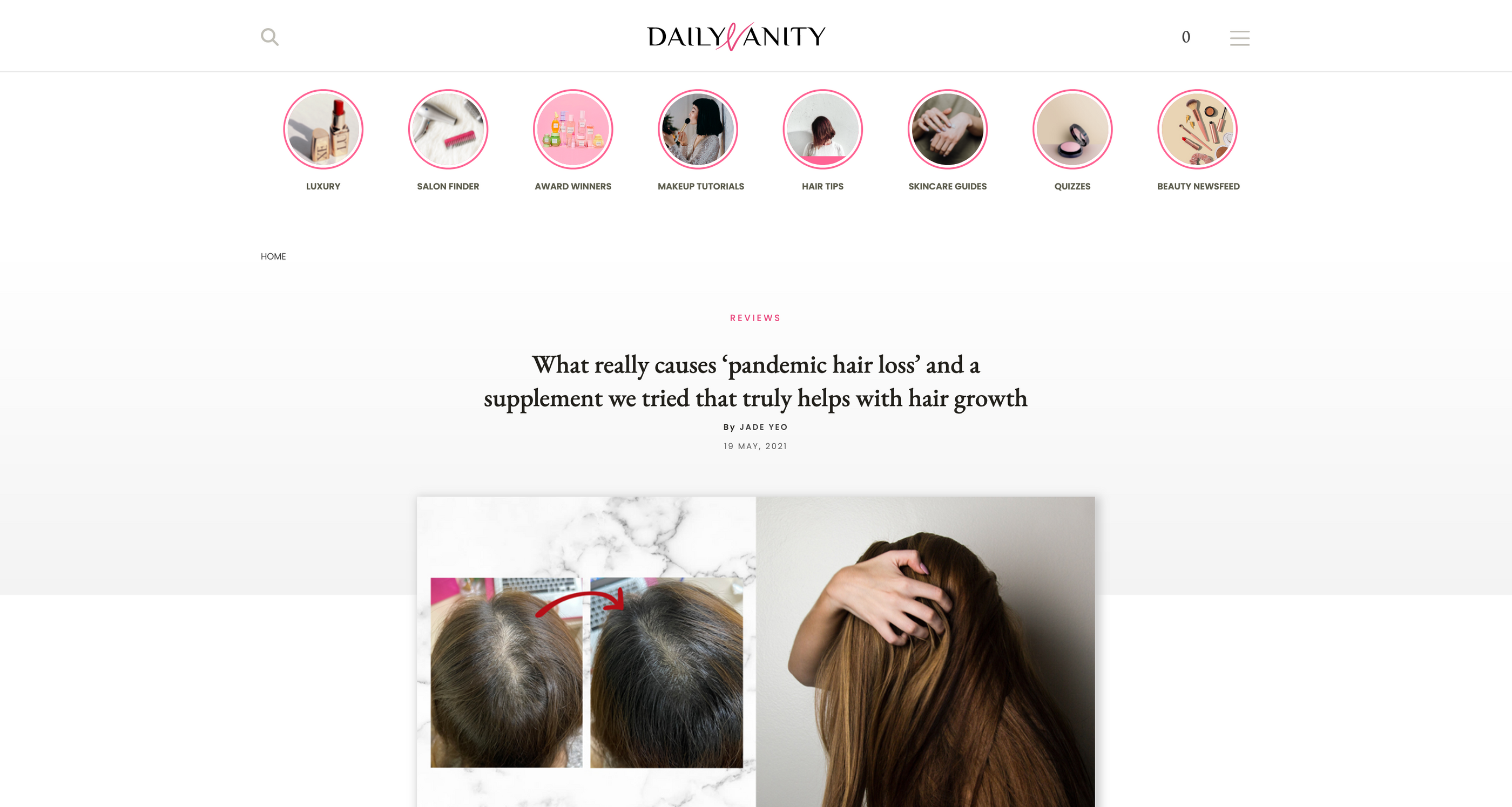 What Really Causes ‘Pandemic Hair Loss’ and a Supplement We Tried That Truly Helps With Hair Growth by Daily Vanity