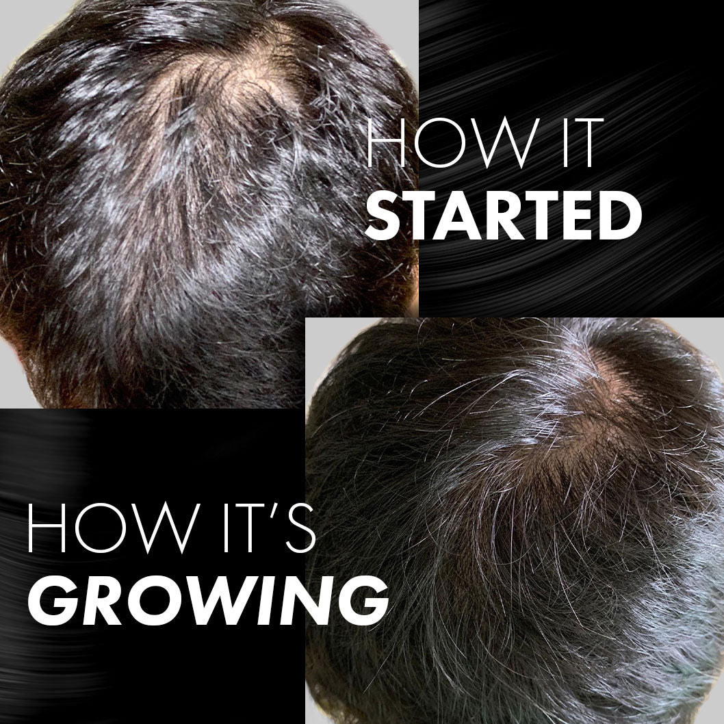 MIRIQA® Professional Hair Nutrition Supplement (Free Gift)