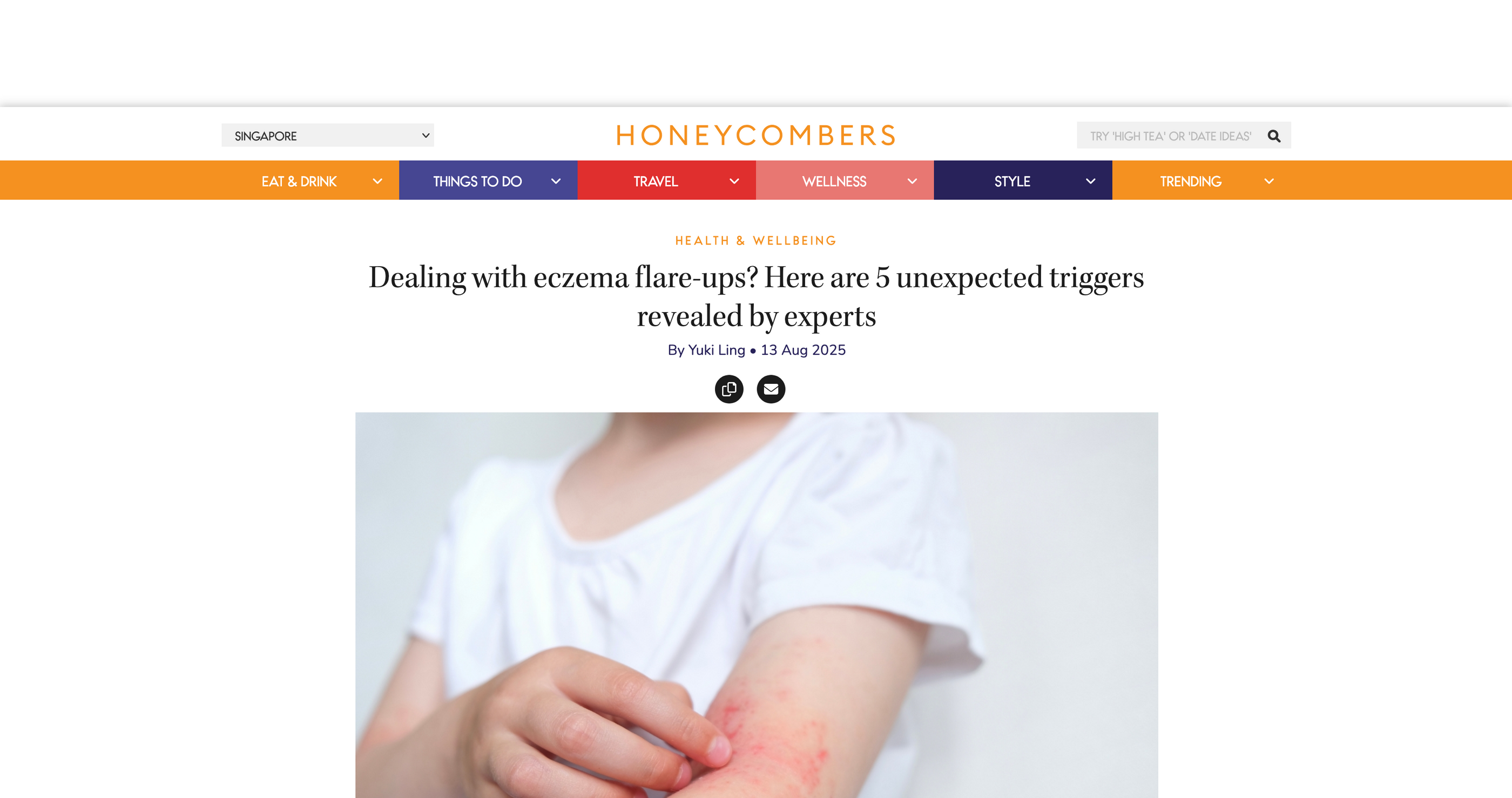 Dealing with eczema flare-ups? Here are 5 unexpected triggers revealed by experts