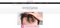 Experiencing Hair Fall, Thinning or Hair Loss? Here’s What You Might Be Missing!