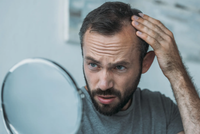 The Connection Between Stress and a Receding Hairline: What You Need to Know