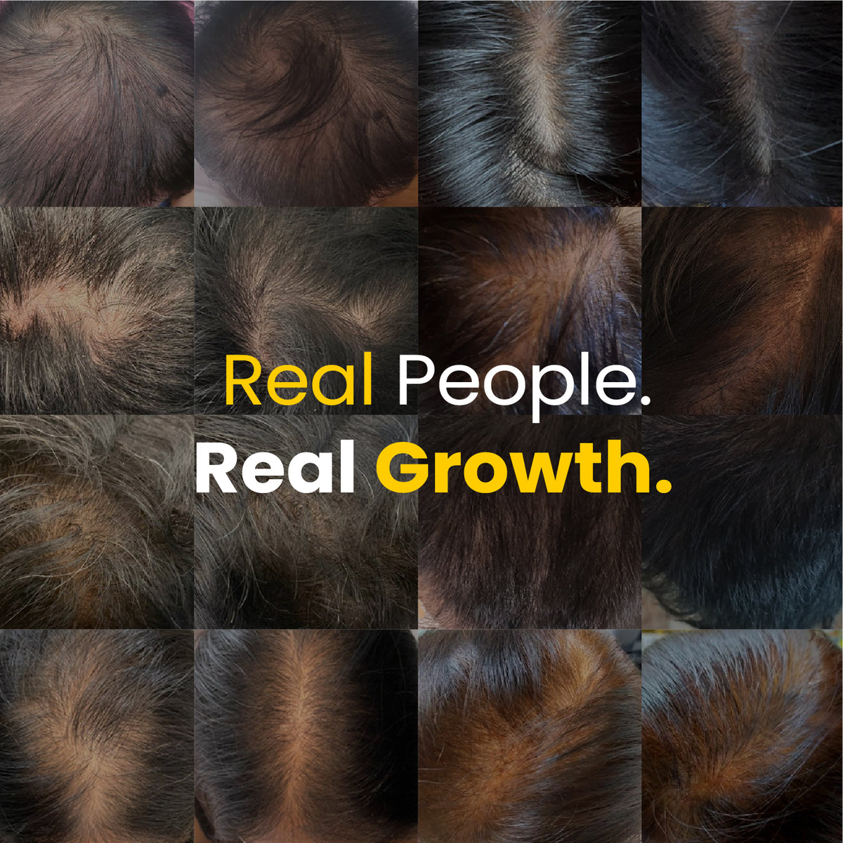 MIRIQA® Professional Hair Nutrition Supplement