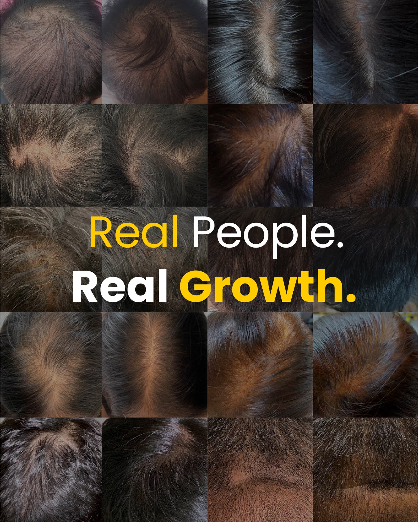 MIRIQA® Professional Hair Nutrition Supplement