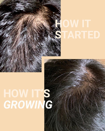 Before and After using MIRIQA Professional Hair Supplement