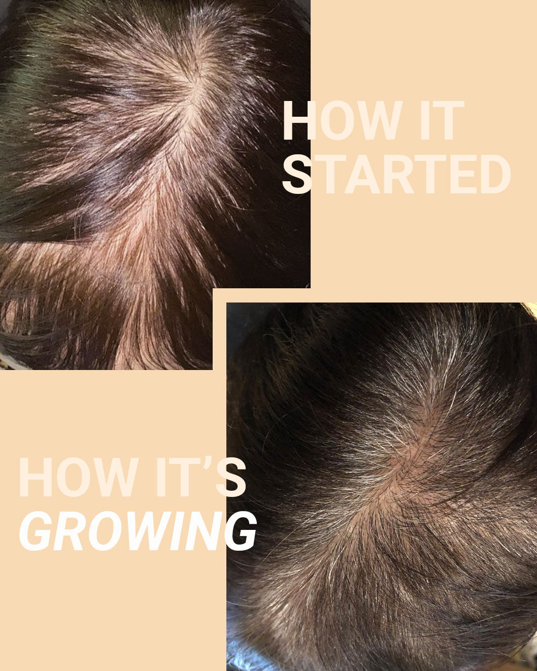 Before and After using MIRIQA Professional Hair Supplement