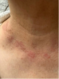 Month 0