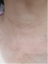 Month 2